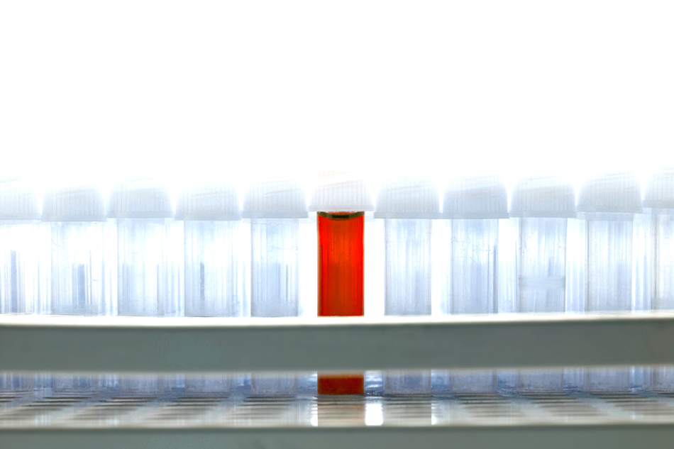 image of a red sample among clear samples to illustrate diagnostic testing